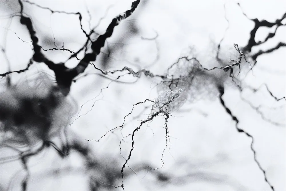 Neurones under a microscope